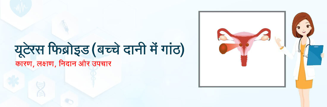 यूटेरस फ़िब्रोइड (बच्चे दानी में गांठ)- के कारण, लक्षण, निदान और उपचार